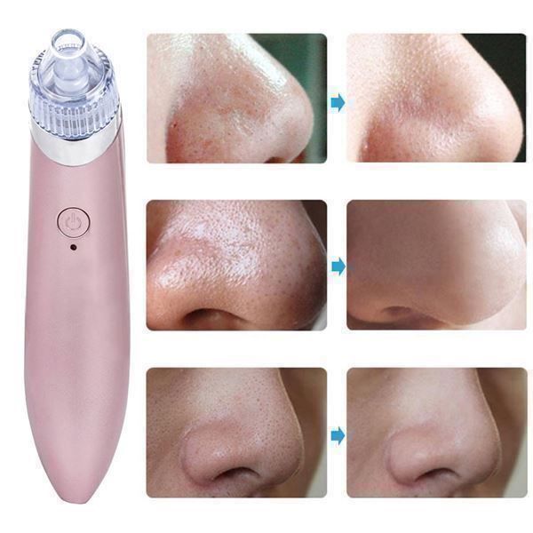 Removedor De Puntos Negros